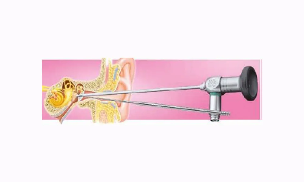Endoscopic Ear Surgery