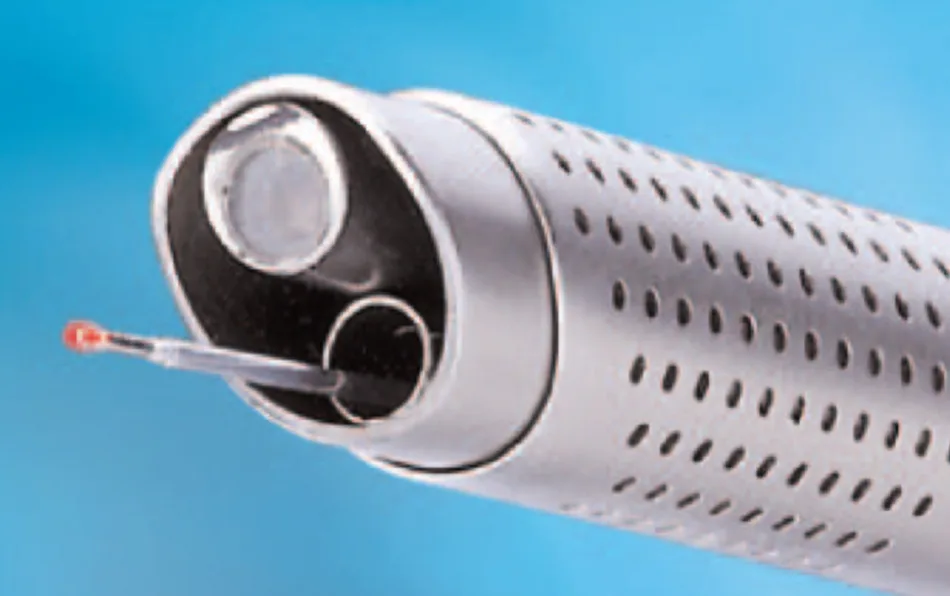 Laser Enucleation