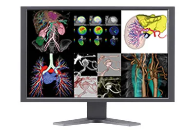 Synapse® 3D