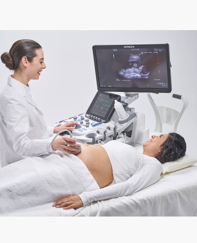 ARIETTA 850 - Görsel 4