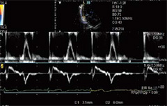 ARIETTA 850 - Görsel 7