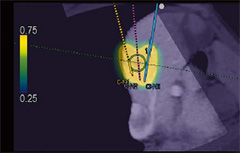 ARIETTA 850 - Görsel 8