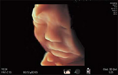 ARIETTA 850 - Görsel 9