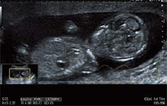 ARIETTA 850 - Görsel 10