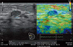 ARIETTA 850 - Görsel 14
