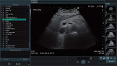 ARIETTA 850 - Görsel 15