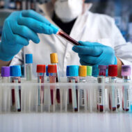 LSA Tekli Antijen Kitleri