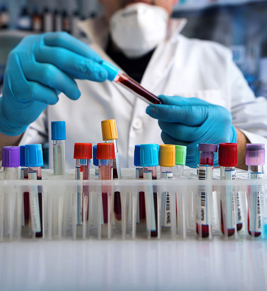 LSA Tekli Antijen Kitleri