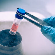 Primer Hücre Sistemleri