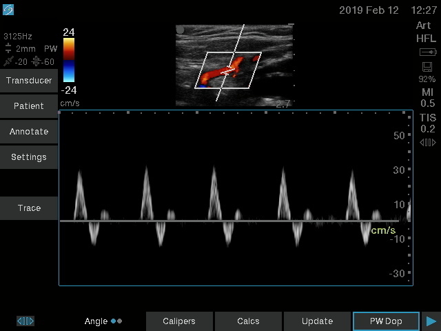 Sonosite SII-VA - Görsel 5