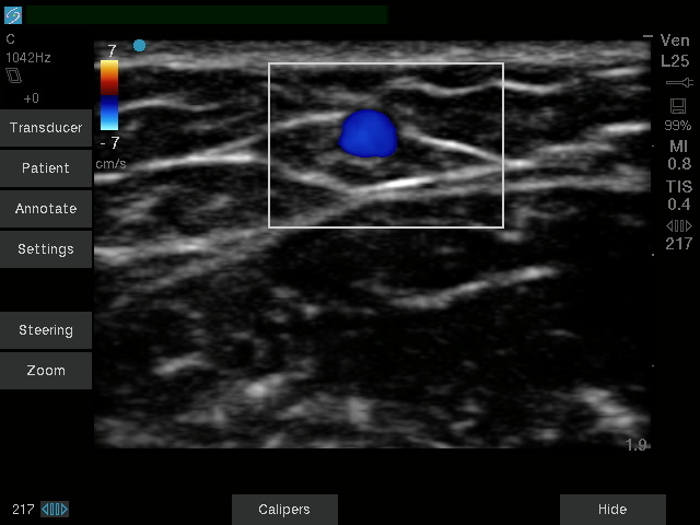 Sonosite SII-VA - Görsel 4