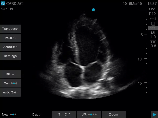 Sonosite SII-VA - Görsel 7