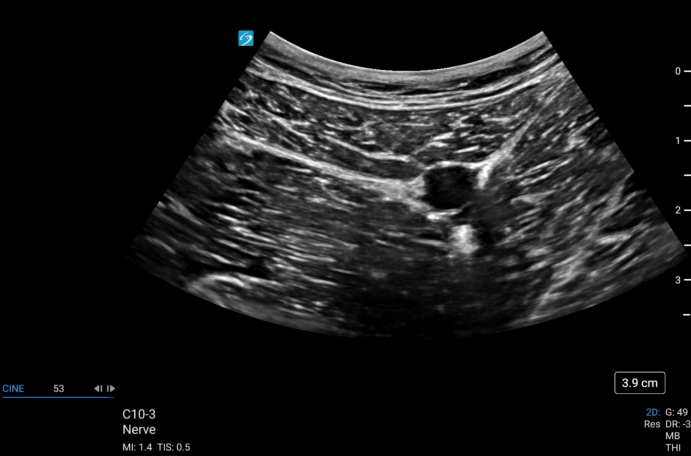 Sonosite LX - Görsel 11