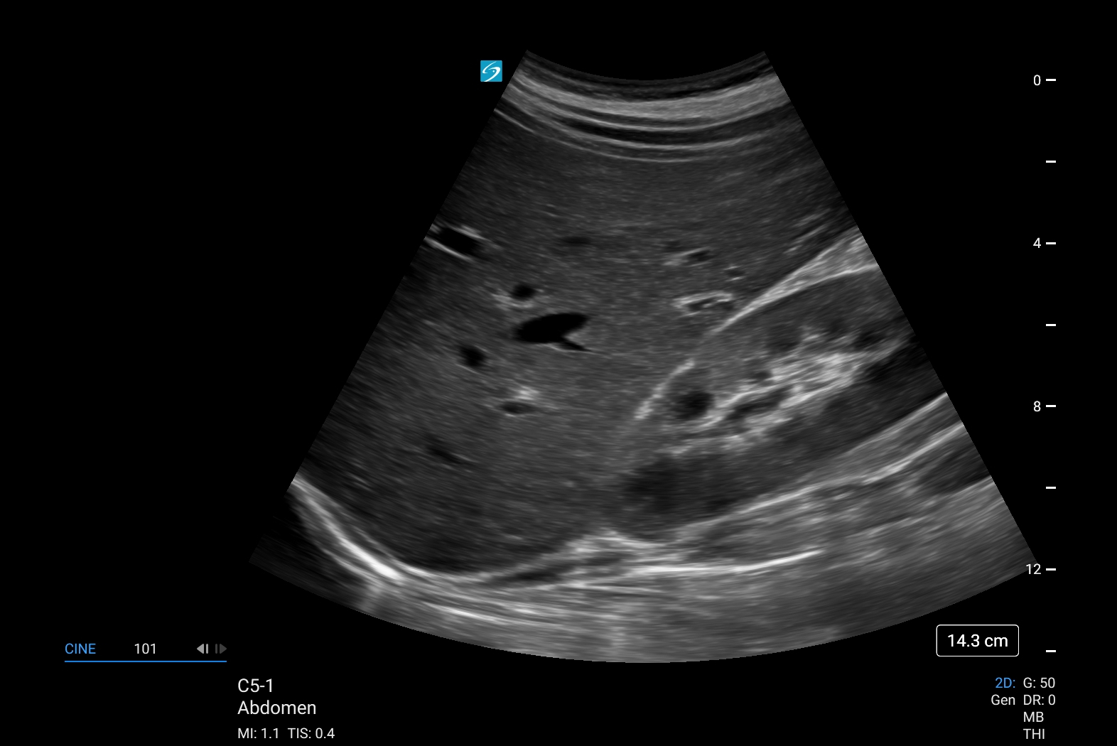 Sonosite LX - Görsel 6