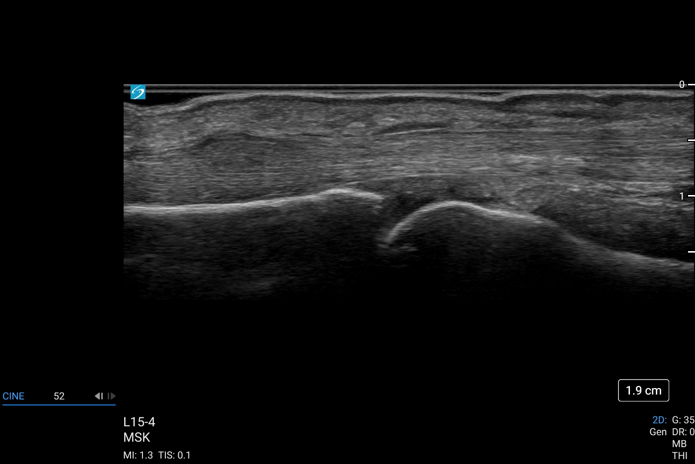 Sonosite LX - Görsel 9