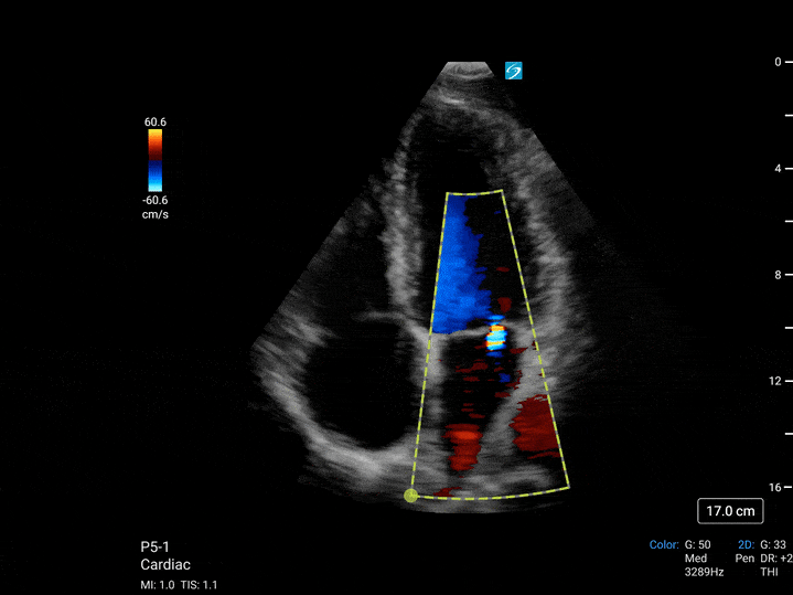 Sonosite LX - Görsel 8