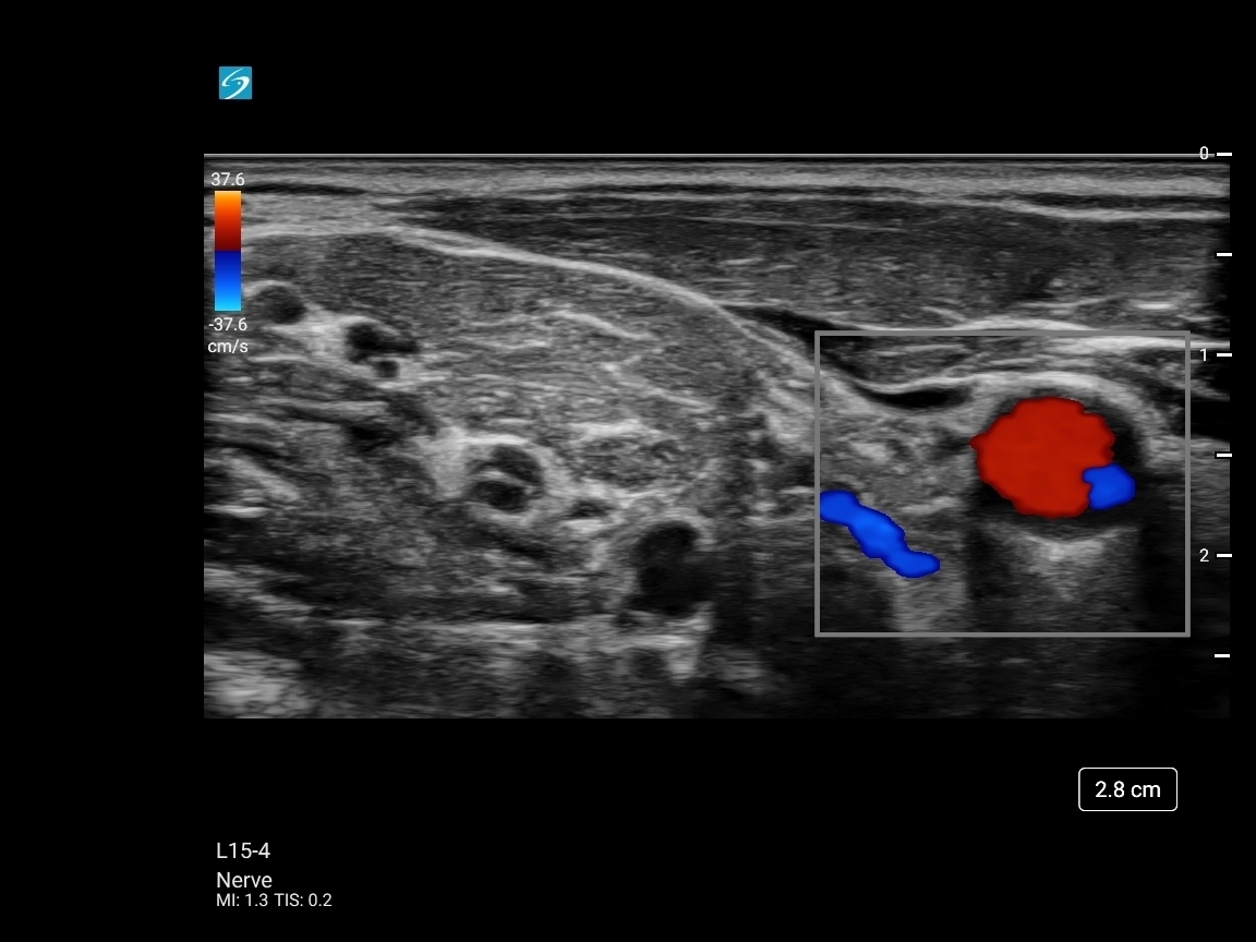 Sonosite ST - Görsel 4