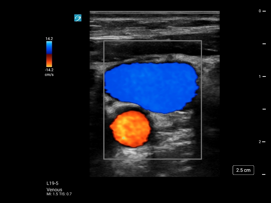 Sonosite ST - Görsel 2
