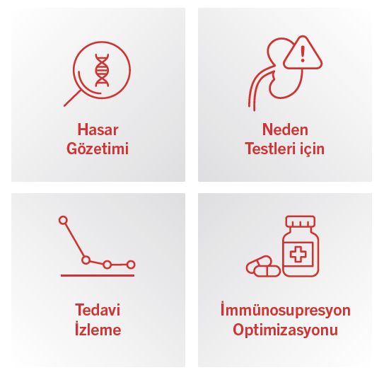 Hücre Dışı DNA Ölçümü ile Nakil Gözetimi