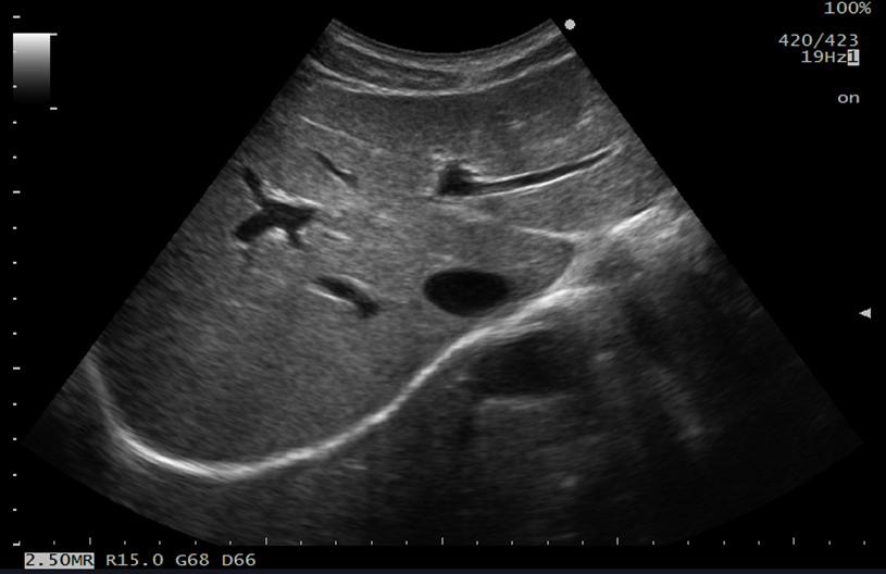 ARIETTA 50 - Görsel 12