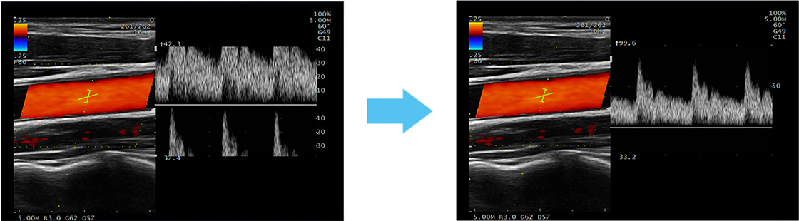 ARIETTA 50 - Görsel 6