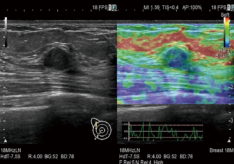 ARIETTA 750 DeepInsight - Görsel 12