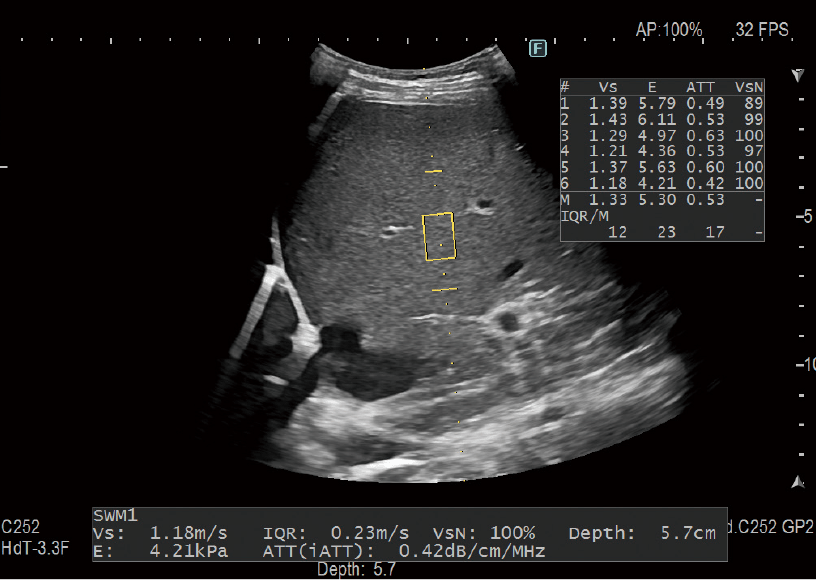 ARIETTA 750 DeepInsight - Görsel 13