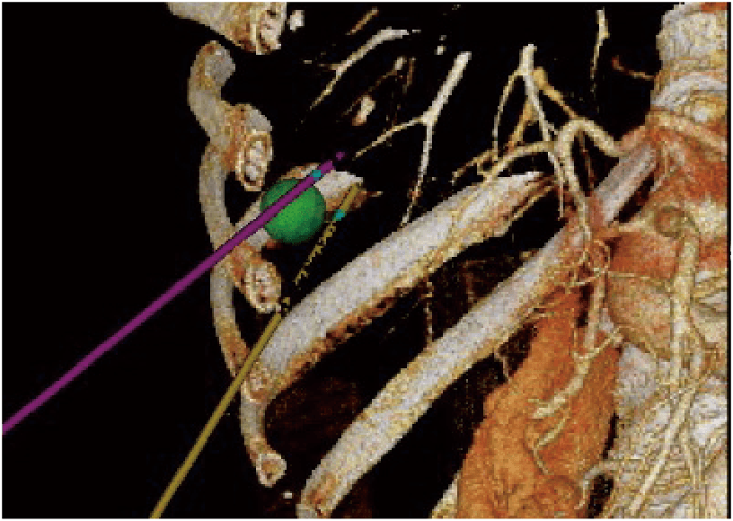 ARIETTA 750 DeepInsight - Görsel 2