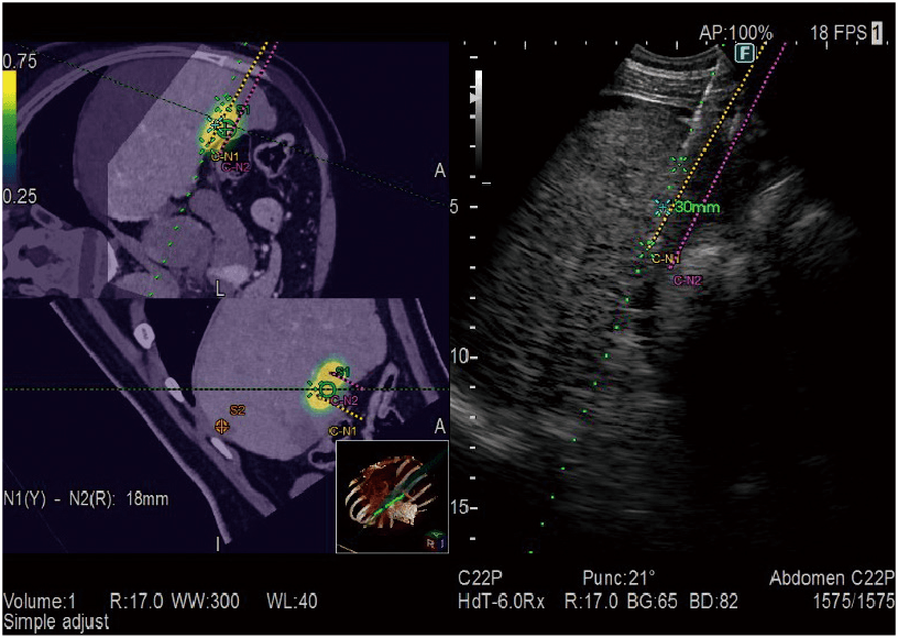 ARIETTA 750 DeepInsight - Görsel 3