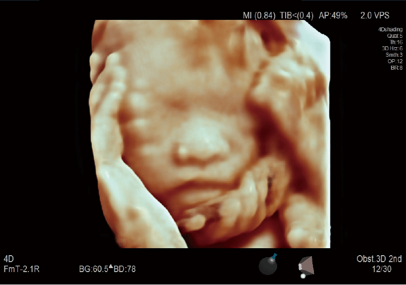 ARIETTA 750 DeepInsight - Görsel 4