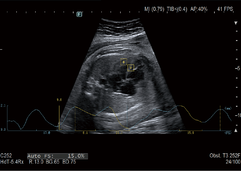 ARIETTA 750 DeepInsight - Görsel 5