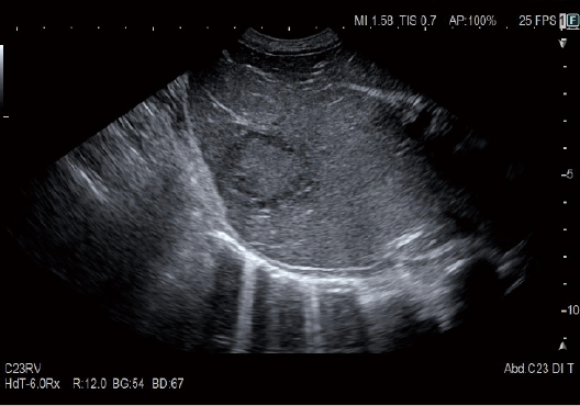 ARIETTA 750 DeepInsight - Görsel 10