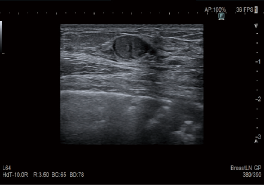 ARIETTA 750 DeepInsight - Görsel 11