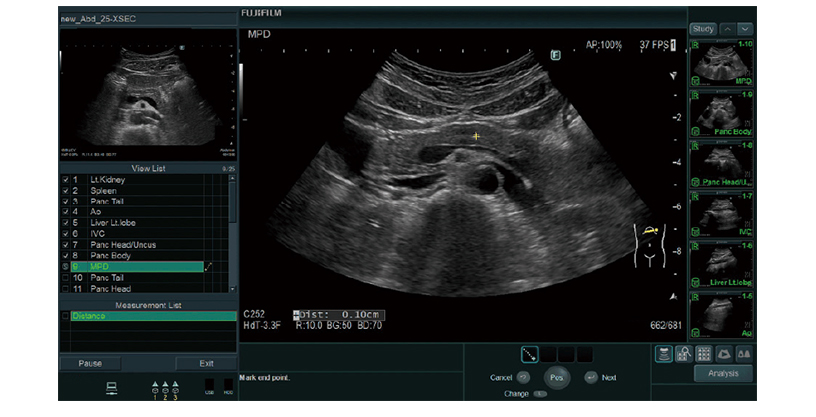 ARIETTA 750 DeepInsight - Görsel 6