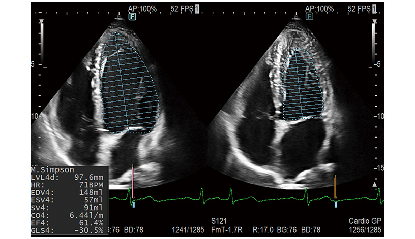 ARIETTA 750 DeepInsight - Görsel 7