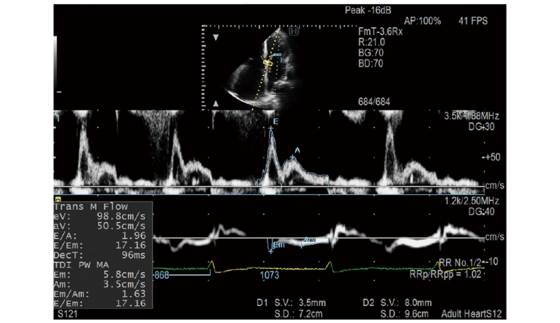 ARIETTA 750 DeepInsight - Görsel 8