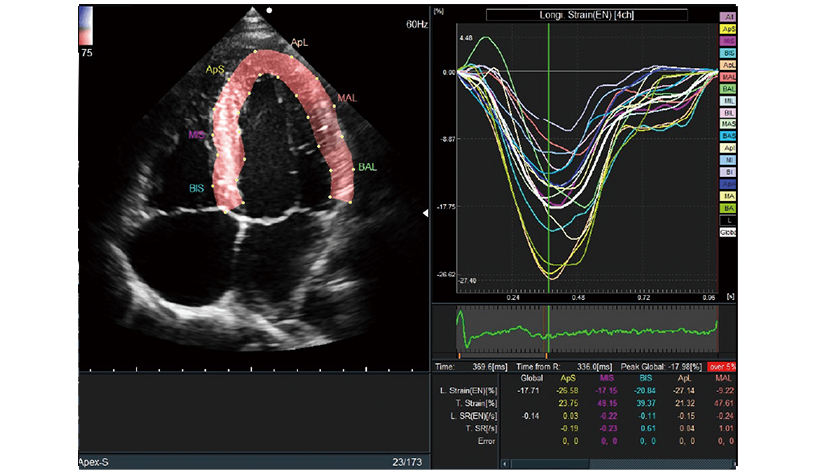 ARIETTA 750 DeepInsight - Görsel 9