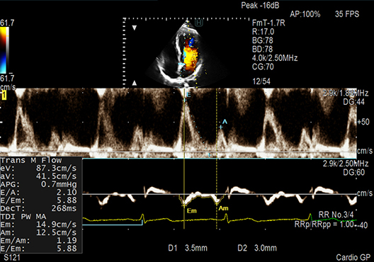 ARIETTA 750SE - Görsel 5