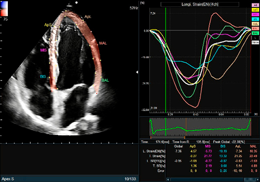 ARIETTA 750SE - Görsel 3