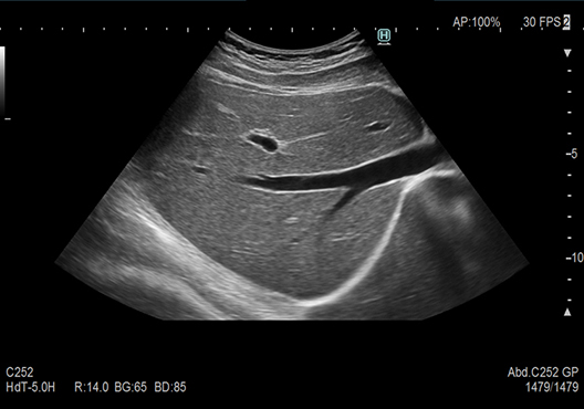 ARIETTA 750SE - Görsel 4