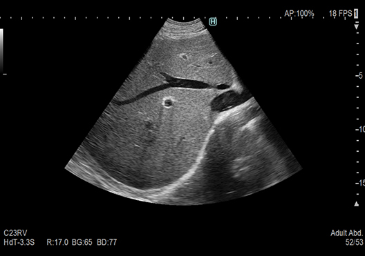 ARIETTA 750SE - Görsel 6
