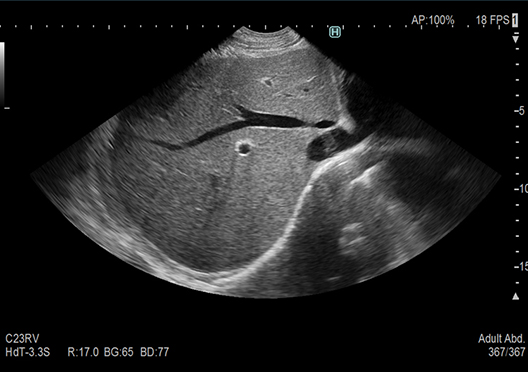 ARIETTA 750SE - Görsel 7