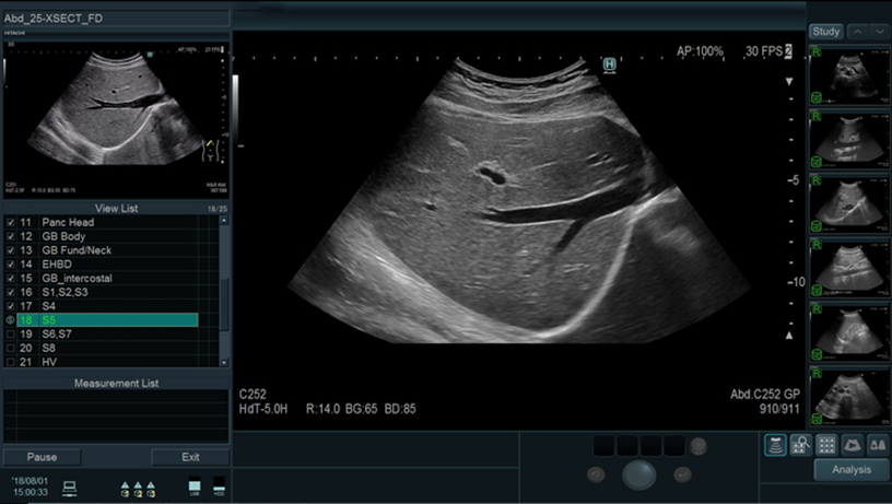 ARIETTA 750SE - Görsel 9