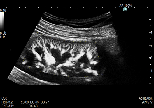 ARIETTA 750SE - Görsel 11