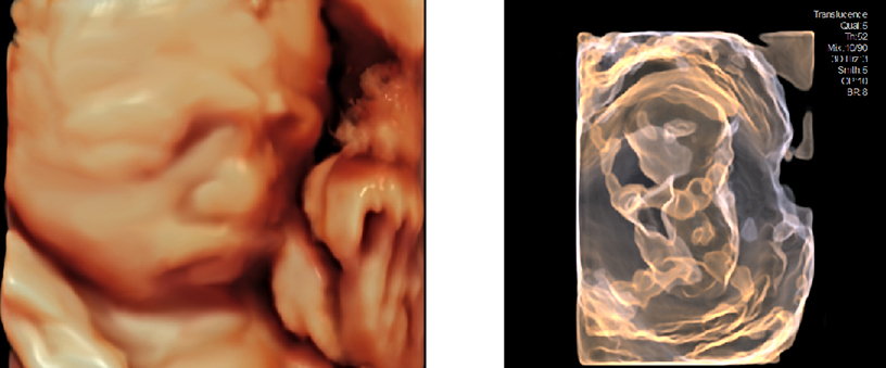 ARIETTA 750SE - Görsel 12